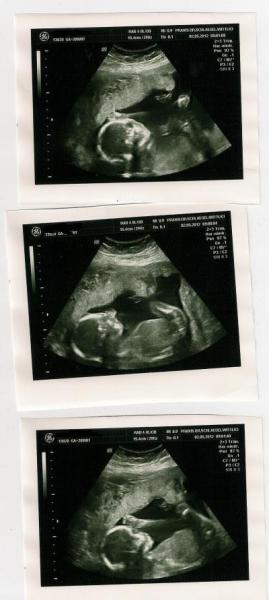 Bild zu Heute Bergfest und VU gehabt + Bild - Forum für September - Mamis