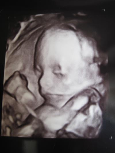 Bild zu Bericht FD von gestern + Outing + 4D Bild + leider nicht alles ok :-( - Forum für September - Mamis