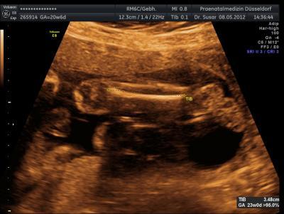 Bild zu Fotos von der FD gestern :) - Forum für September - Mamis