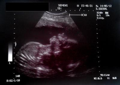 Bild zu Heute Frauenarzttermin und Bildchen bekommen :-) - Forum für September - Mamis