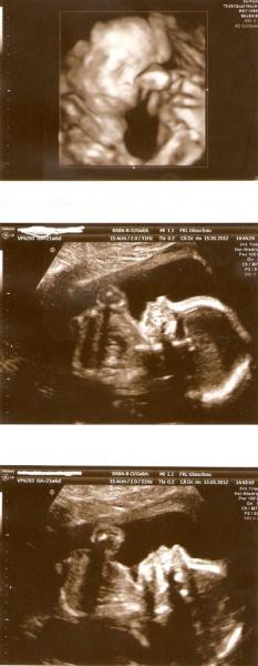 Bild zu zurück von FD - Forum für September - Mamis