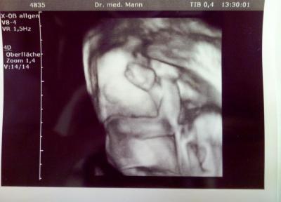 Bild zu Hatte heute 3D-Ultraschall - Forum für September - Mamis