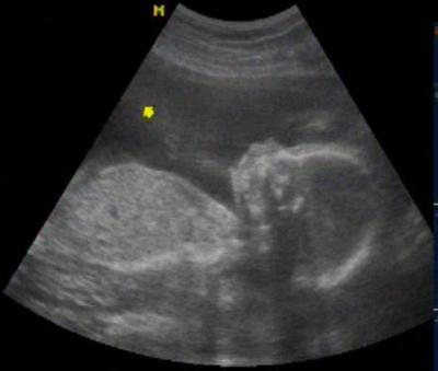 Bild zu Wollt mal Bilder zeigen :-) - Forum für September - Mamis