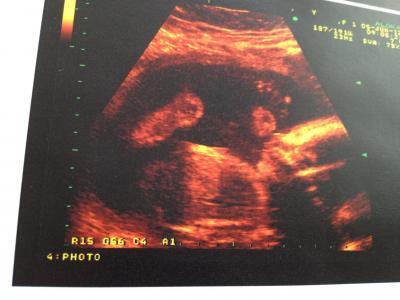 Bild zu Allgemeines Update, FD und 3D :) - Forum für September - Mamis