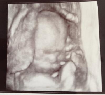 Bild zu Meine Prinzessin - Forum für September - Mamis