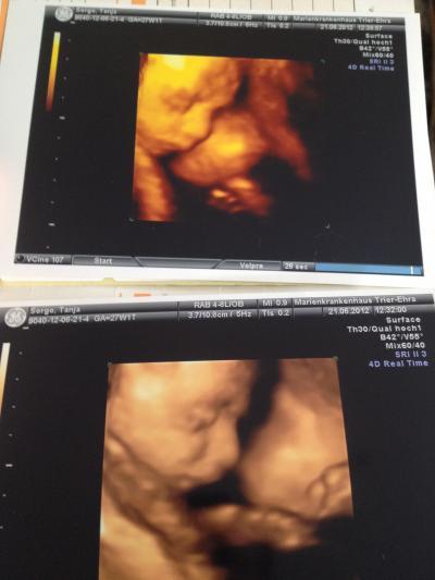 Bild zu 3D Photos :) - Forum für September - Mamis