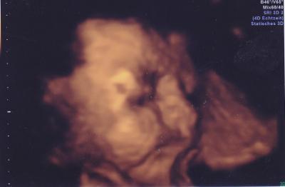 Bild zu 3D BIld - Forum für September - Mamis