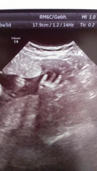 Bild zu Mir gehts heut scheisse! - Forum für September - Mamis