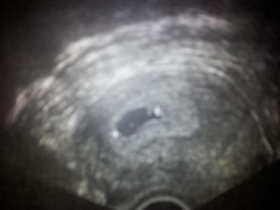Bild zu So nun bin ich auch offiziell dabei! :) - Forum für September - Mamis