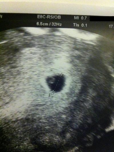 Bild zu So nun mal wieder Shooting - Forum für September - Mamis
