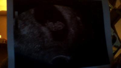 Bild zu unser zweites bild - Forum für September - Mamis