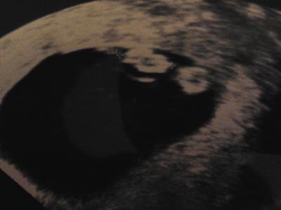 Bild zu @Fledermaus mein bildle.... - Forum für September - Mamis