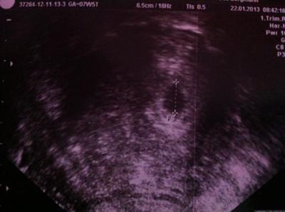 Bild zu So zurück vom doc - Forum für September - Mamis