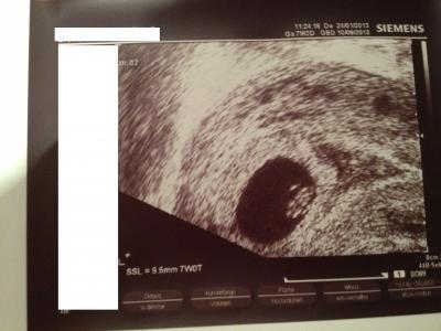 Bild zu zurück vom FA :-) - Forum für September - Mamis
