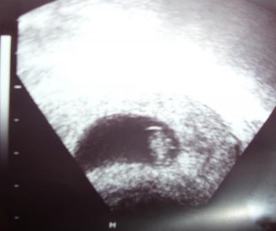 Bild zu Endlich...Bild nachreichen vom Donnerstag! - Forum für September - Mamis
