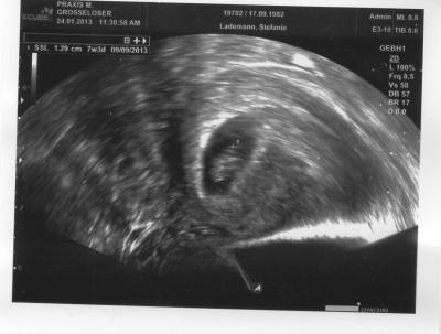 Bild zu 1. Vorsorgetermin - Forum für September - Mamis