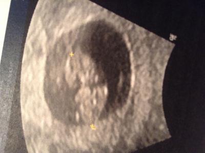Bild zu Foto :) - Forum für September - Mamis