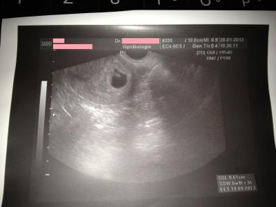 Bild zu Unser erstes Bild - Forum für September - Mamis