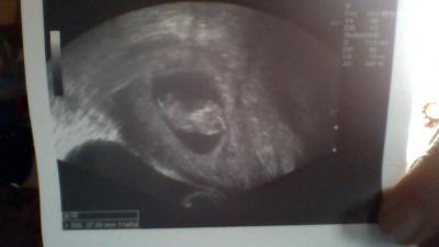 Bild zu beim Gyn - Forum für September - Mamis
