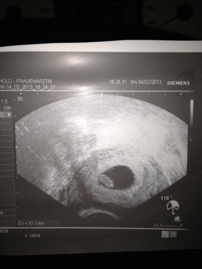 Bild zu Mein Besuch beim FA! - Forum für September - Mamis