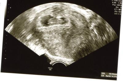 Bild zu Bin wieder da - Forum für September - Mamis
