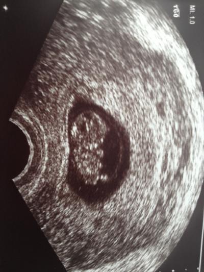 Bild zu Zurück vom Fa ... - Forum für September - Mamis