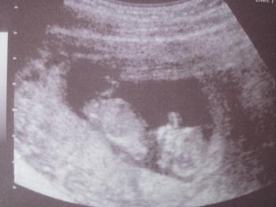 Bild zu zurück vom Doc =) - Forum für September - Mamis