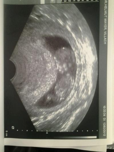 Bild zu Foto von gestern...... - Forum für September - Mamis