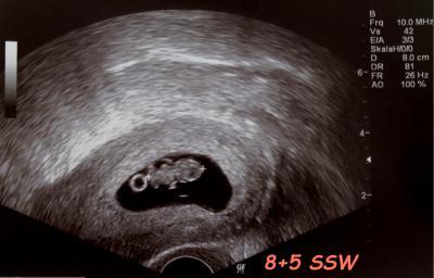 Bild zu Zurück vom FA - Forum für September - Mamis