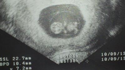Bild zu Foto - Forum für September - Mamis