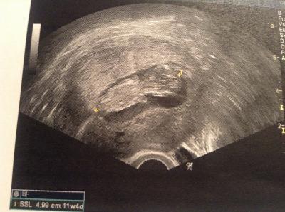 Bild zu Fa- termin gestern und Foto - Forum für September - Mamis