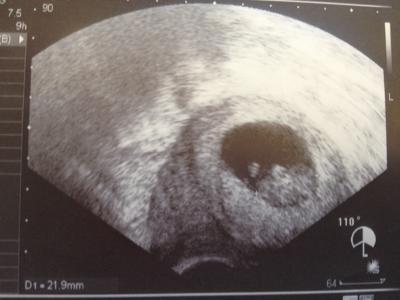 Bild zu Mein Bericht von Montag! - Forum für September - Mamis