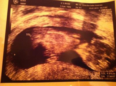 Bild zu Zurück vom FA und sooooo happy :-) - Forum für September - Mamis