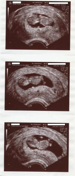 Bild zu FA, MuPa + Bilder von einer Schlafmütze :) - Forum für September - Mamis