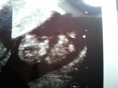Bild zu mein FA Bericht :-) - Forum für September - Mamis