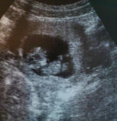 Bild zu Bericht vom Fa Termin - Forum für September - Mamis