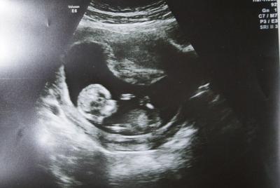 Bild zu Unser Fa-Termin - Forum für September - Mamis