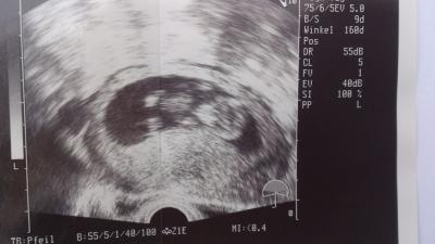 Bild zu fa termin :) - Forum für September - Mamis