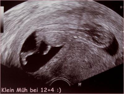 Bild zu Zurück vom FA + Bilder - Forum für September - Mamis