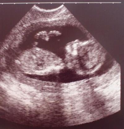 Bild zu Fa Bericht :-) - Forum für September - Mamis