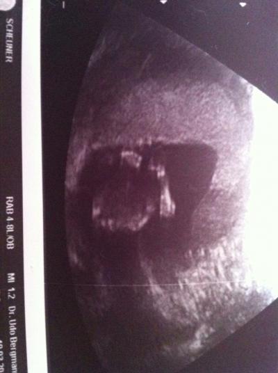 Bild zu auch hier mein chiller baby - Forum für September - Mamis