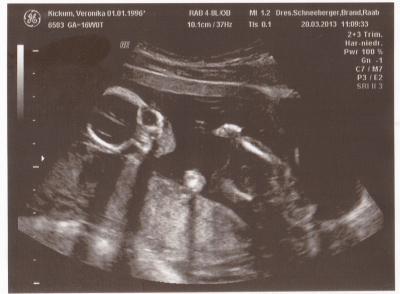 Bild zu FA- Bericht von gestern! - Forum für September - Mamis