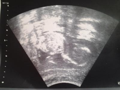 Bild zu Foto ..... - Forum für September - Mamis