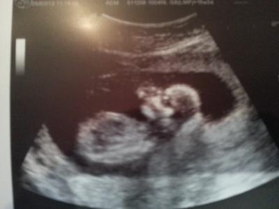 Bild zu Fotos - Forum für September - Mamis