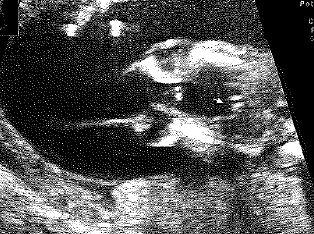 Bild zu Sicheres Outing - Forum für September - Mamis
