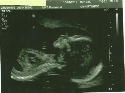 Bild zu Habe hier noch ein Foto - Forum für September - Mamis