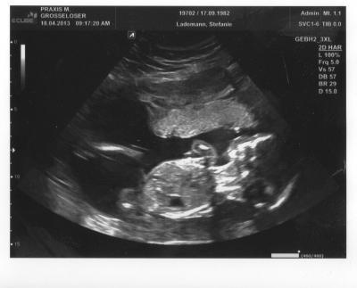Bild zu Zurück vom Vorsorgetermin!!! :-) - Forum für September - Mamis