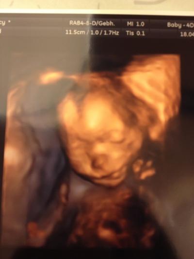 Bild zu Unser kleiner Mann - Forum für September - Mamis