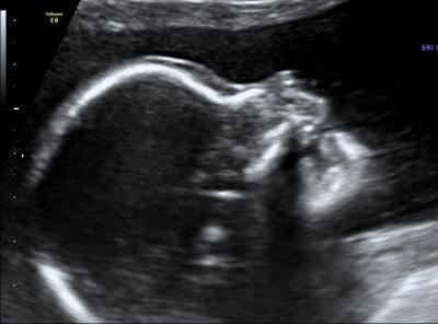 Bild zu Bild :) - Forum für September - Mamis