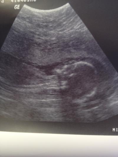 Bild zu Hier noch Bild - Forum für September - Mamis